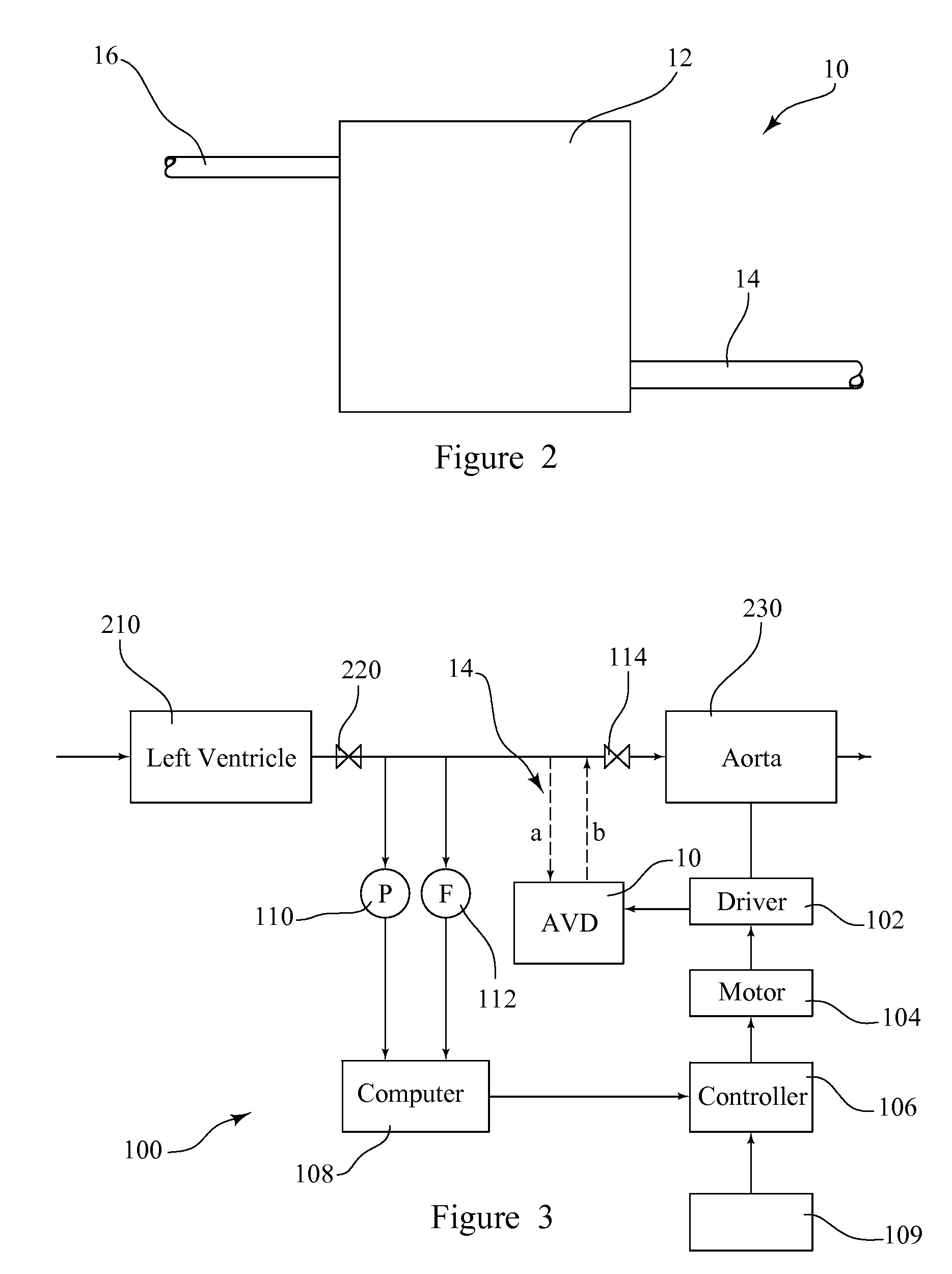 System and method for providing cardiac support and promoting myocardial recovery