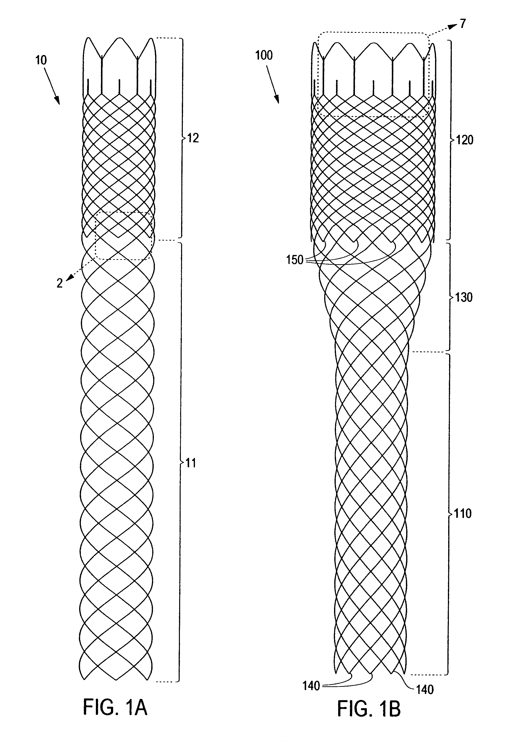 Braided stent and method for its manufacture