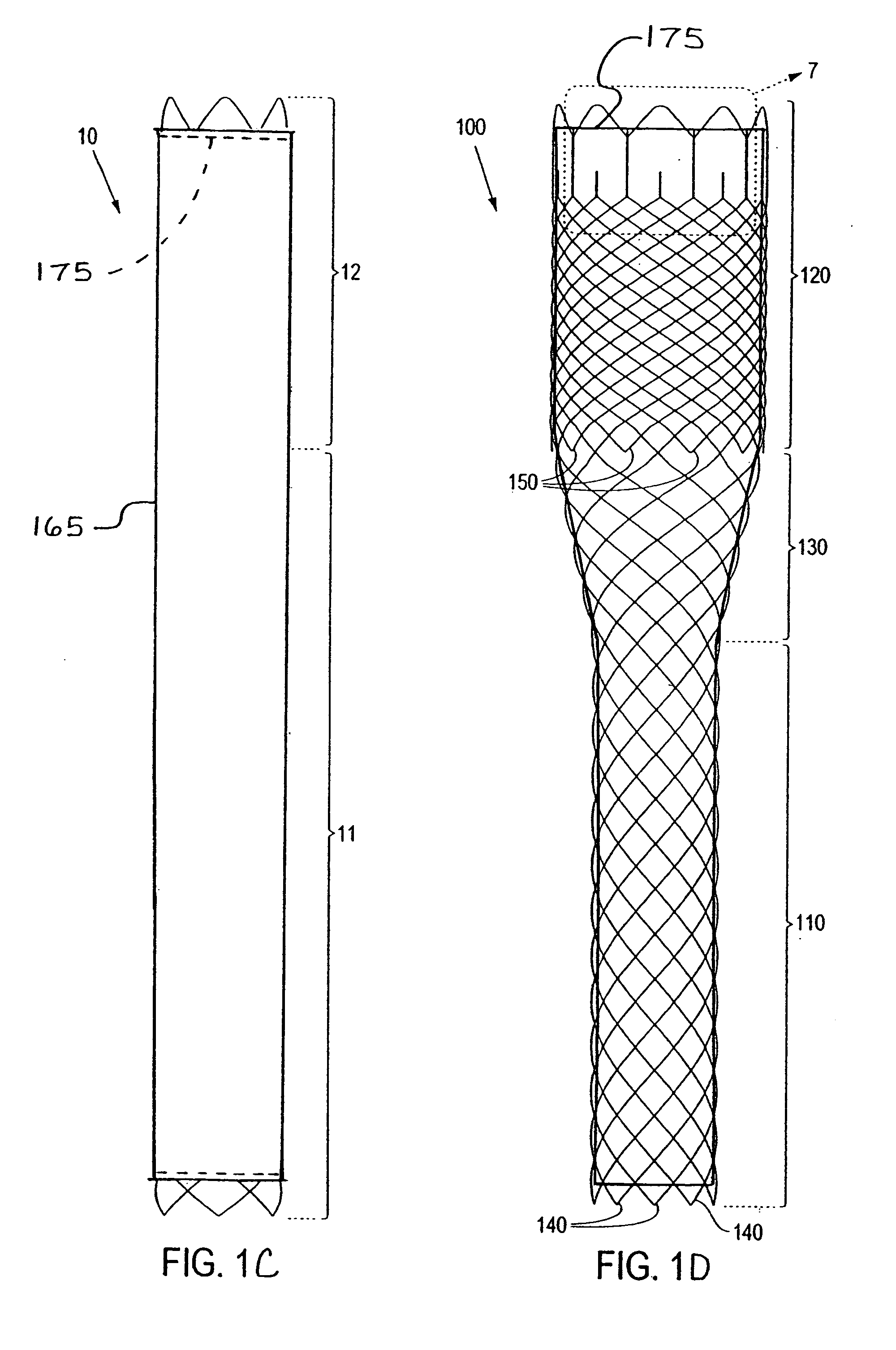 Braided stent and method for its manufacture