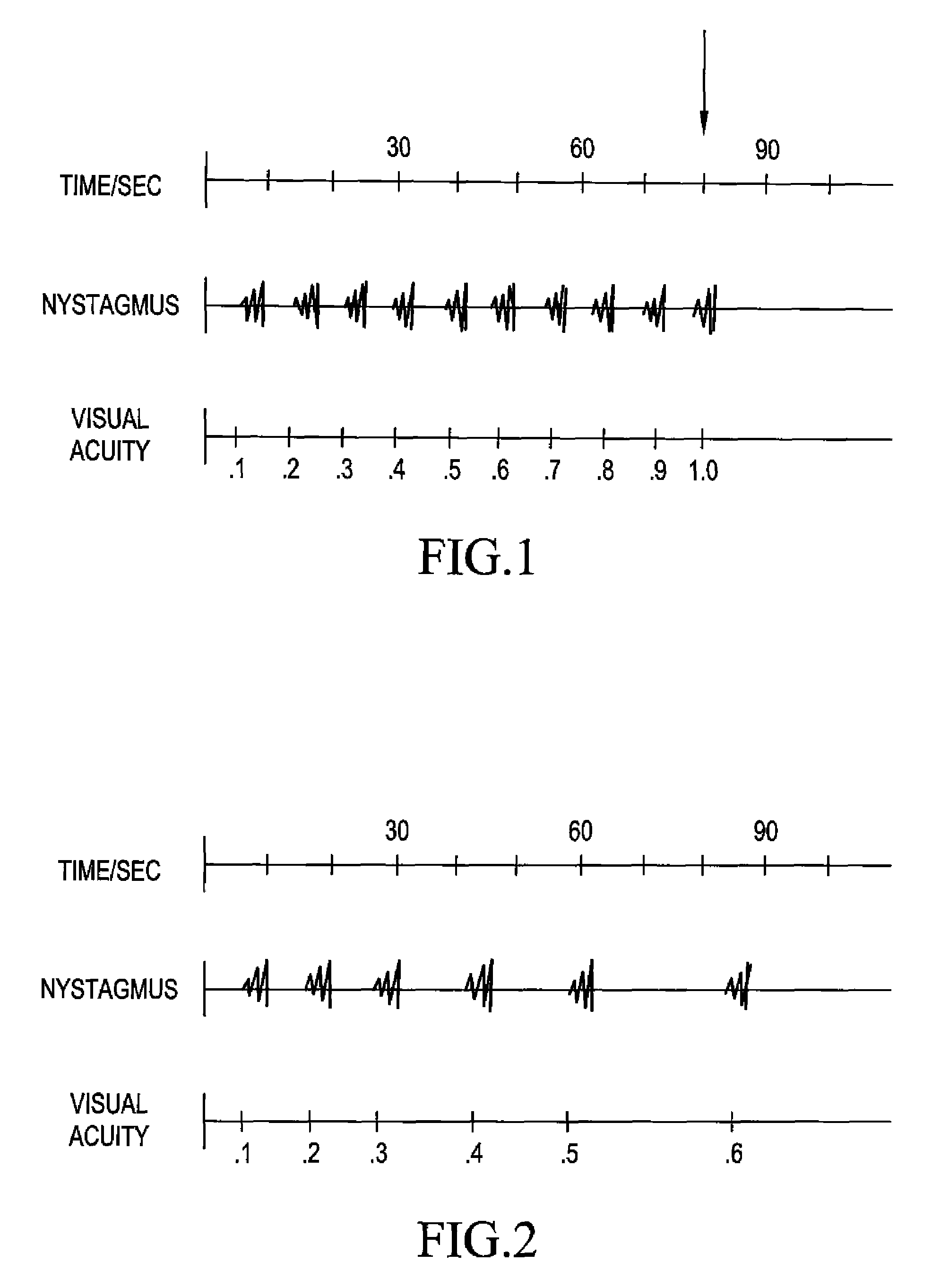 Process and apparatus for examining the visual functions of the eye