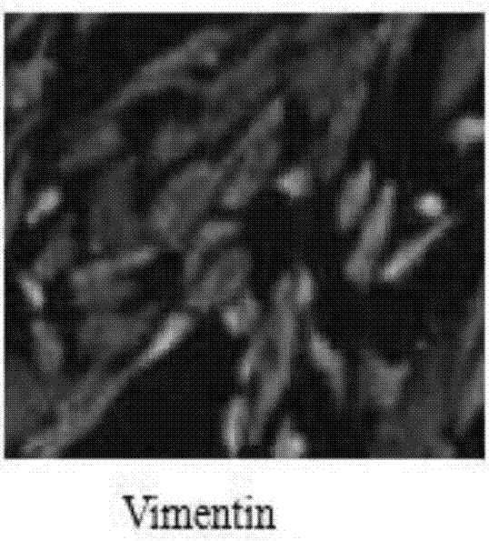 Tissue engineering skin containing appendage and preparation method thereof