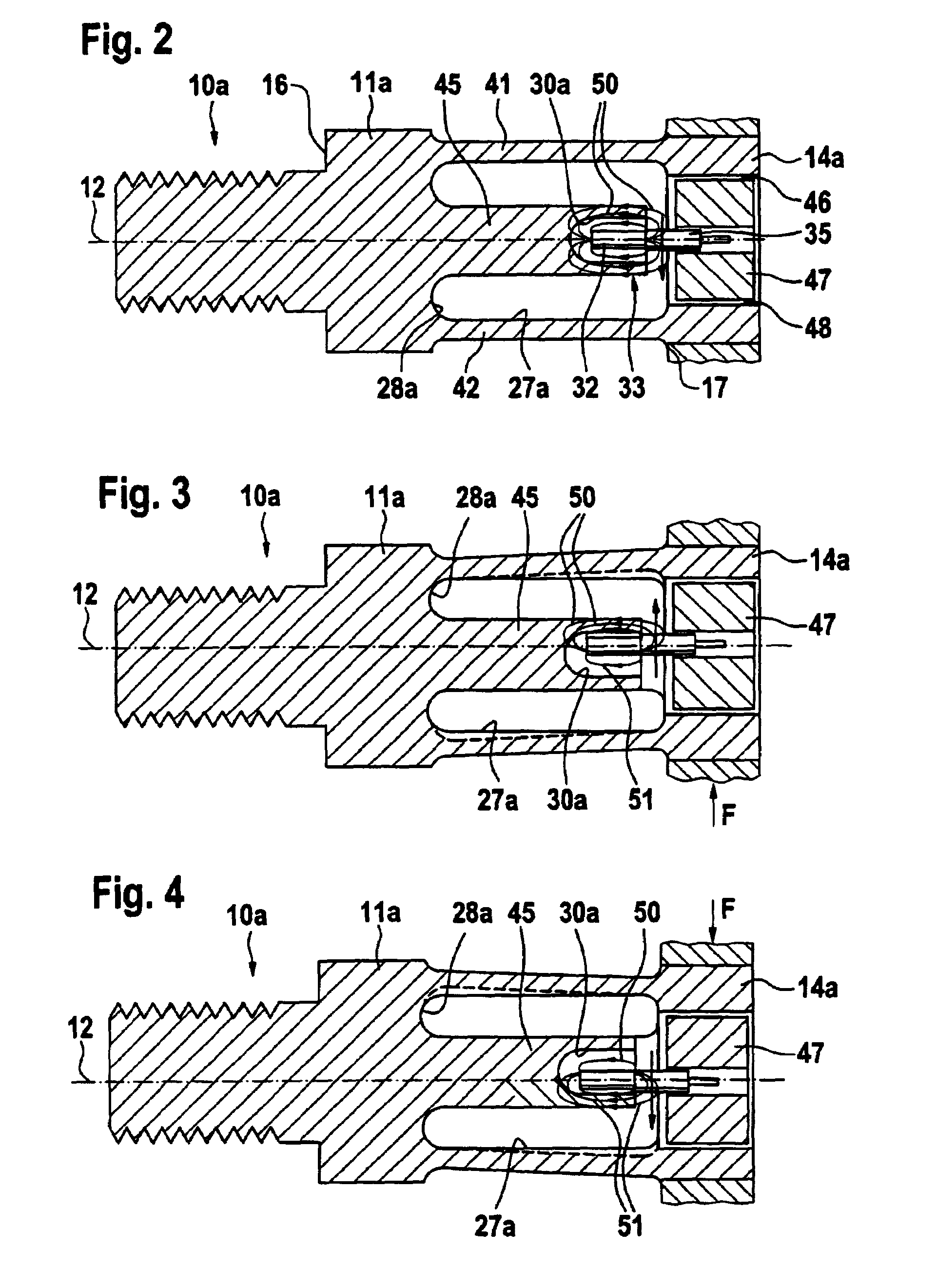 Force measuring device, in particular for seat weight determination in a motor vehicle