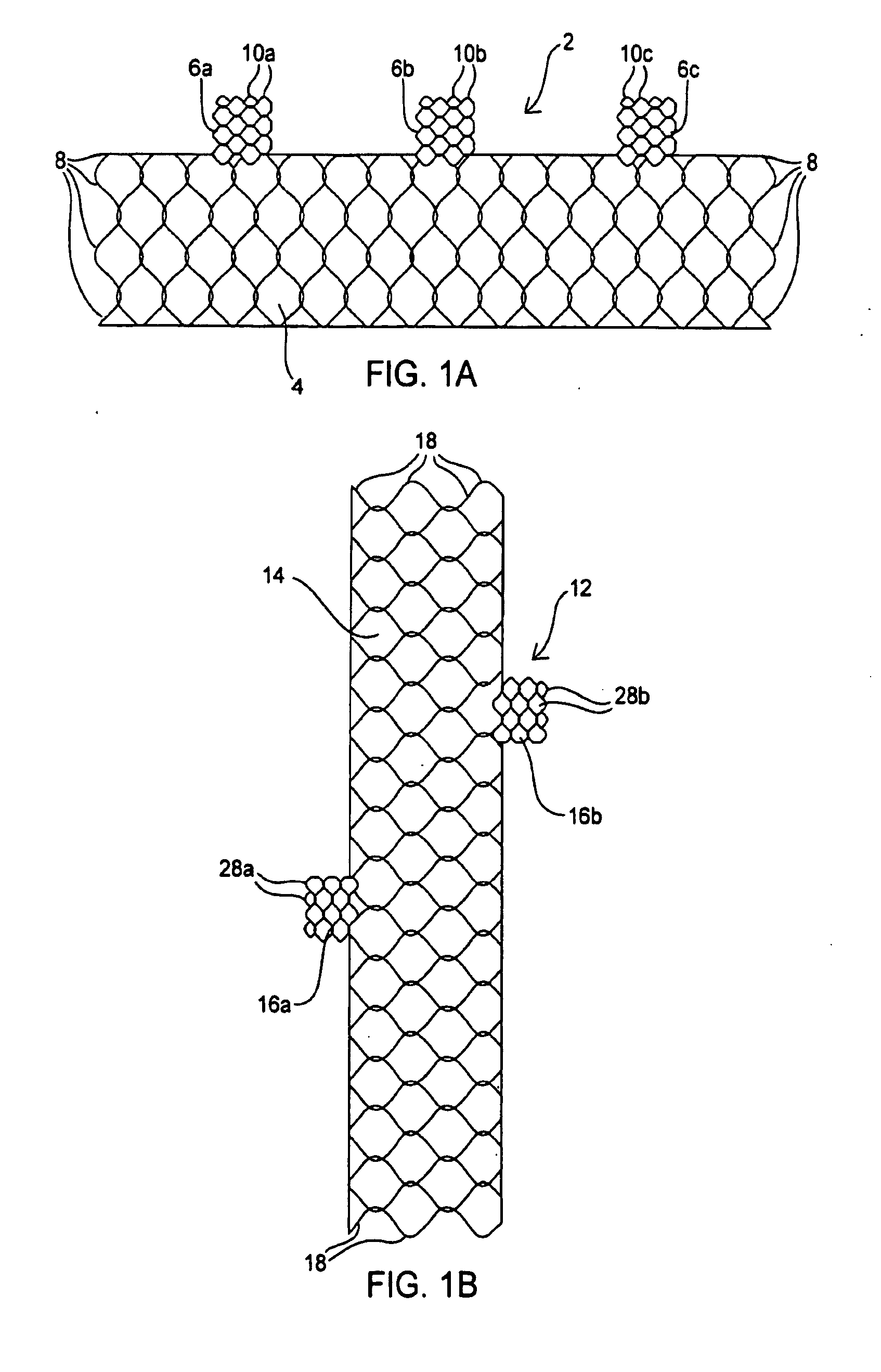 Apparatus and method for deploying an implantable device within the body