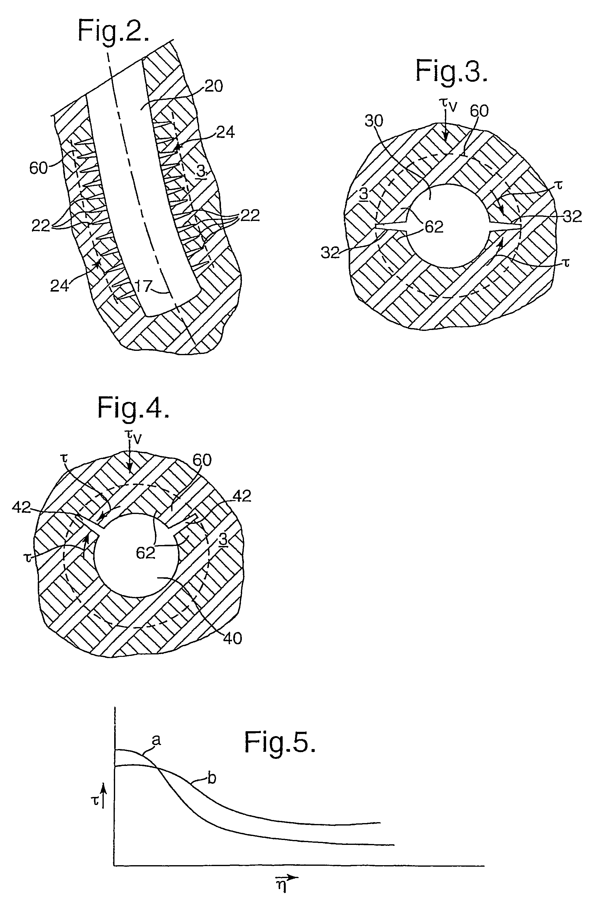 Method of reducing sand production from a wellbore