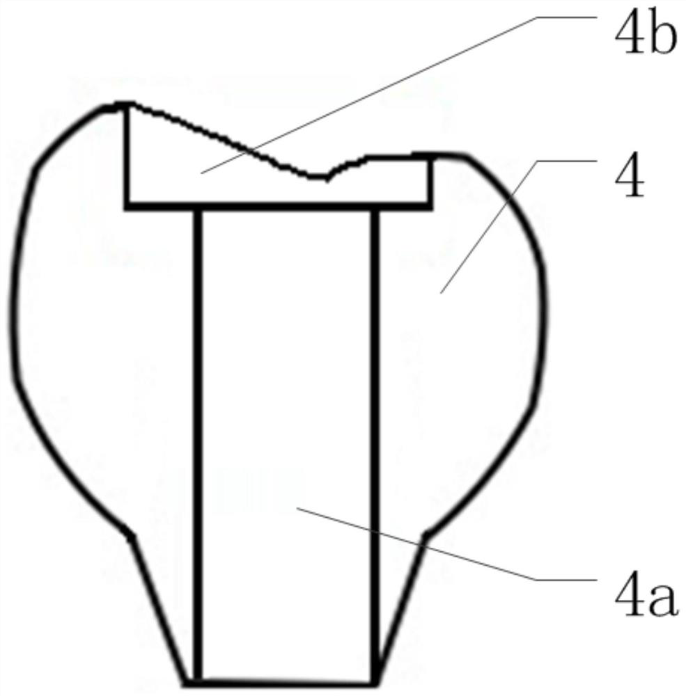 Digital Design Method for Closing Screw Hole of Superimposed Restoration of Dental Implant with Prefabricated Inlay