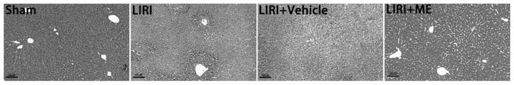 Application of methyleugenol in preparation of medicine for relieving hepatic ischemia-reperfusion injury