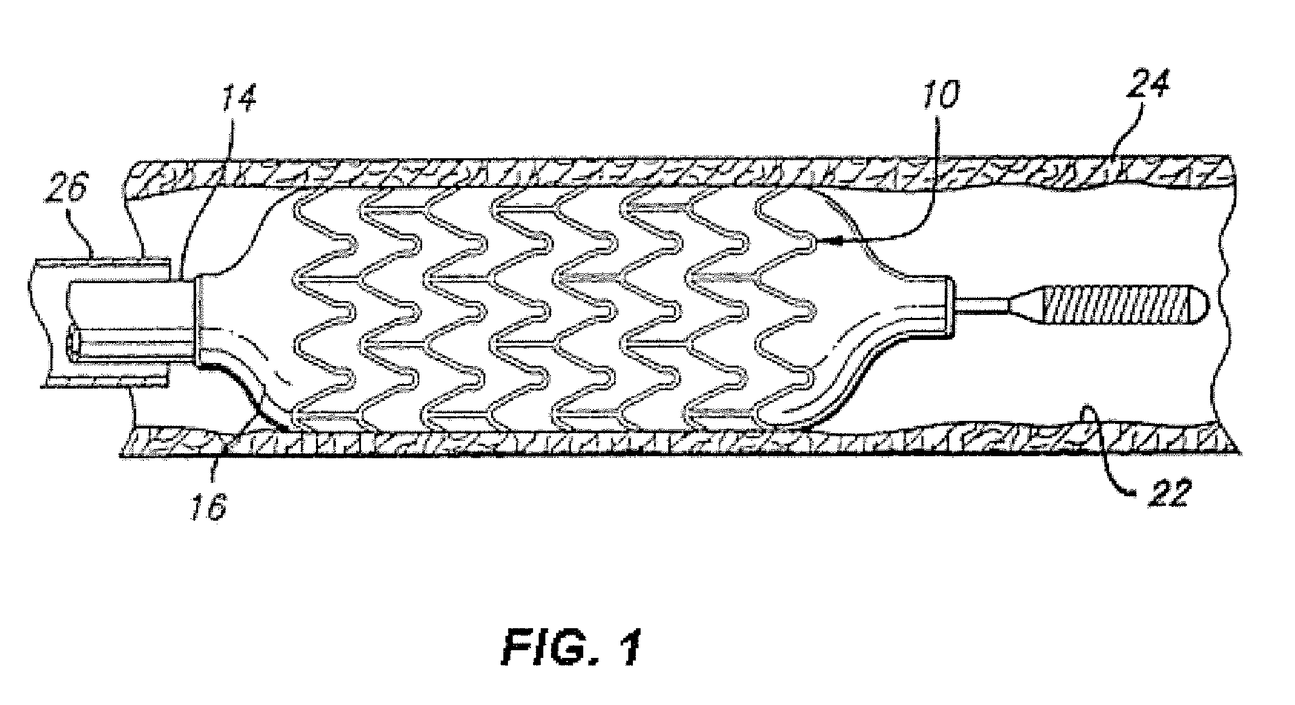 Radiopaque markers comprising binary alloys of titanium