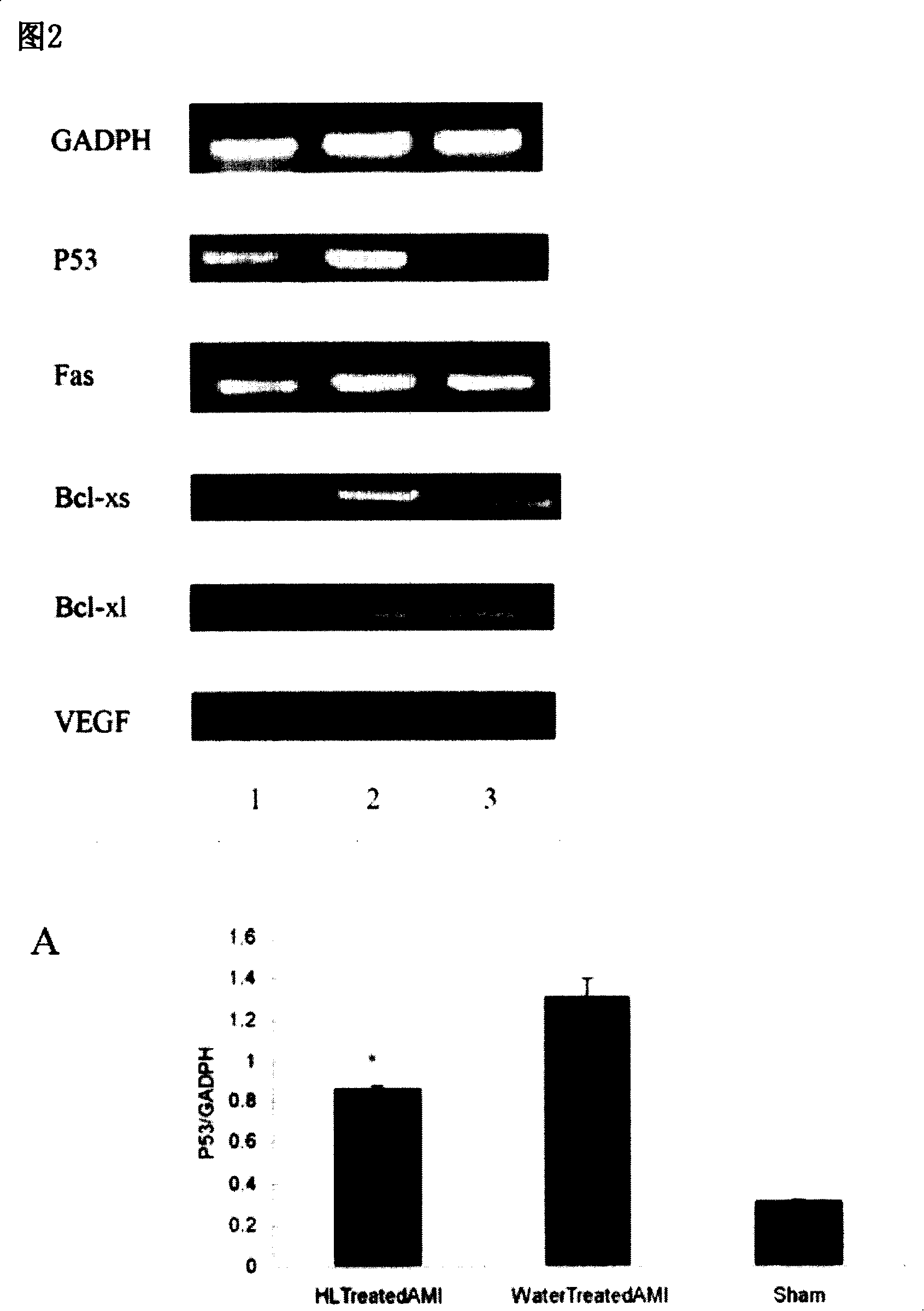 Application of motherwort aqueous extract in the preparation of medicament for curing ischemic heart disease