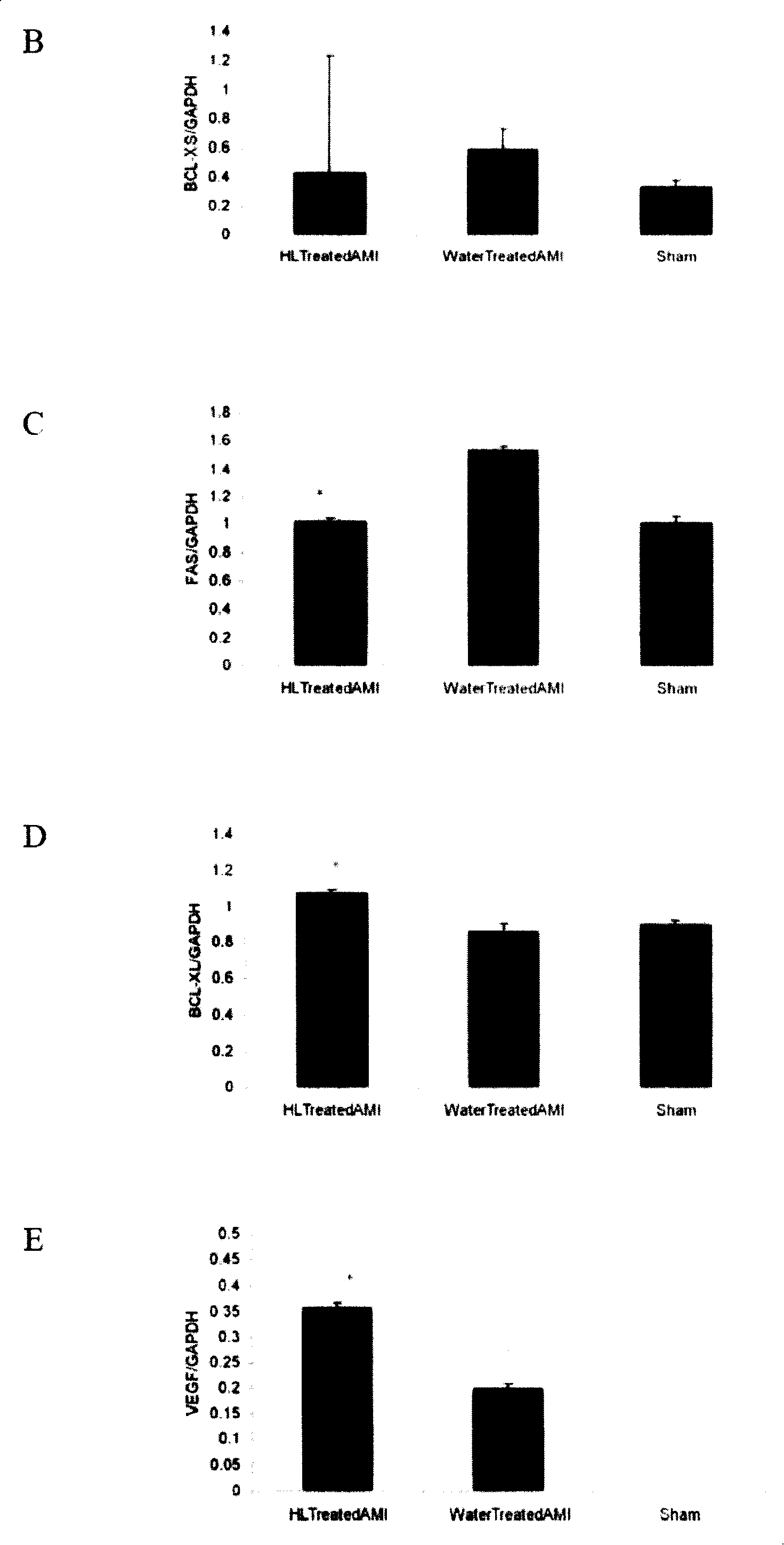 Application of motherwort aqueous extract in the preparation of medicament for curing ischemic heart disease