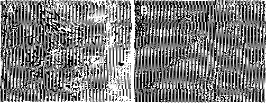 Vascular endothelial cells, and preparation and use thereof