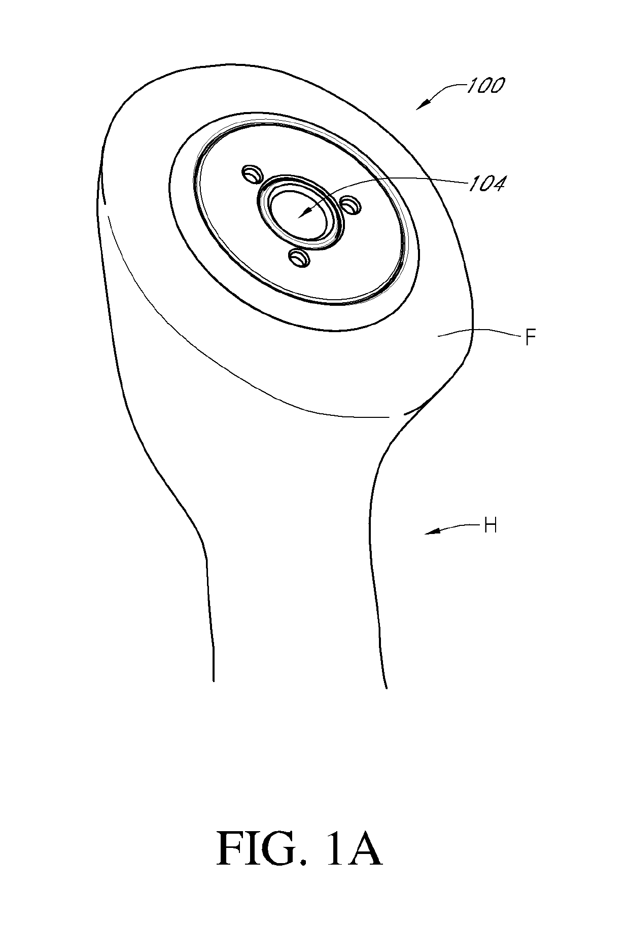 Humeral implant anchor system