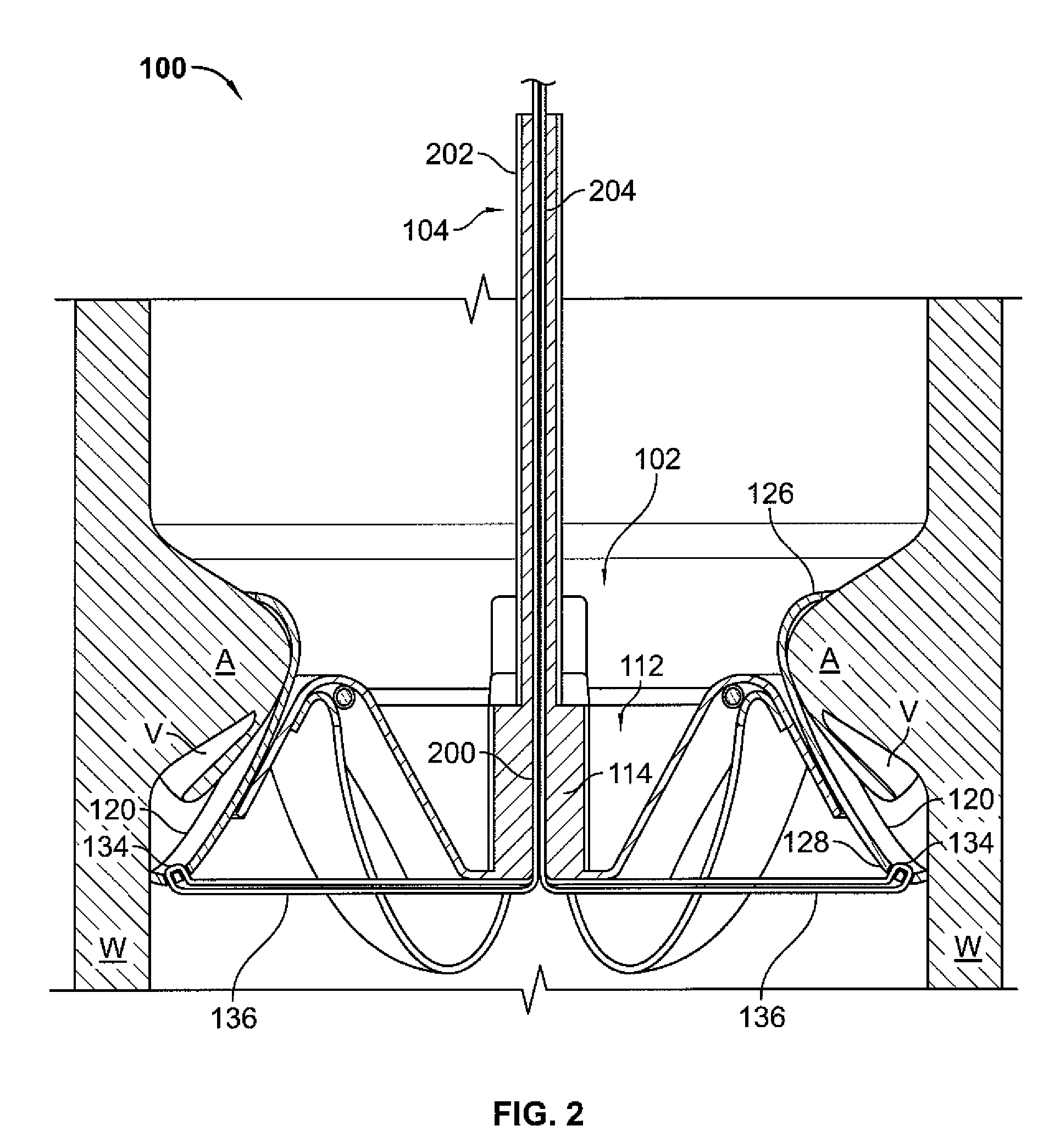 Valve prosthesis systems and methods