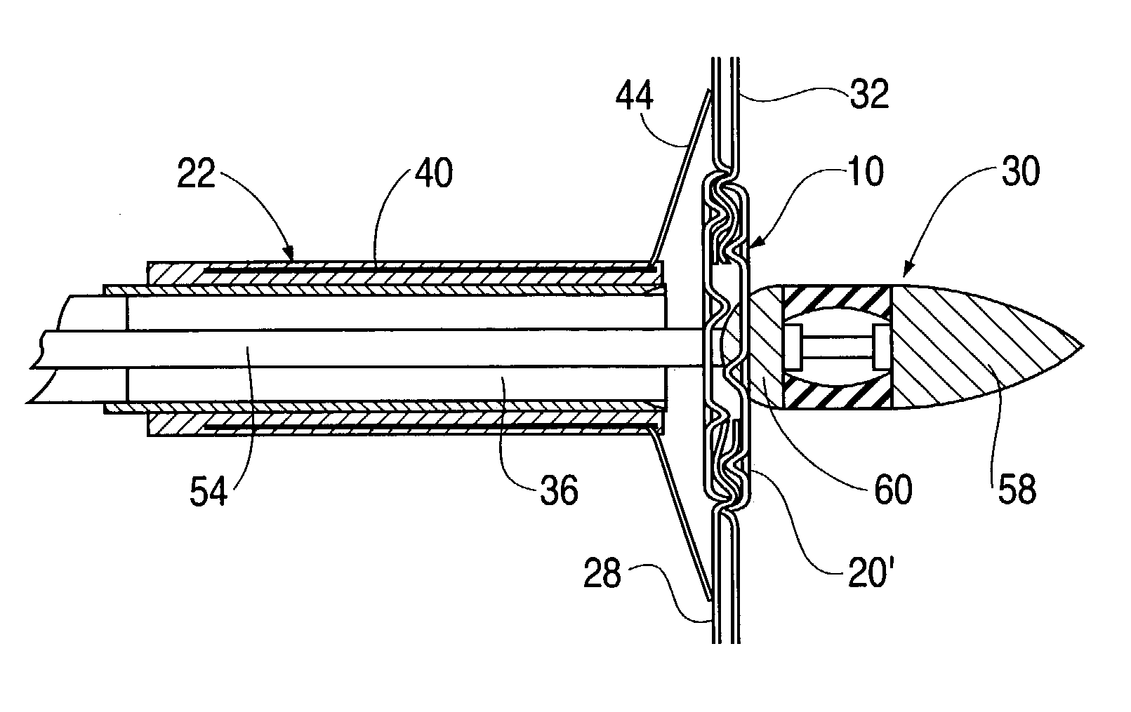 Anastomotic device