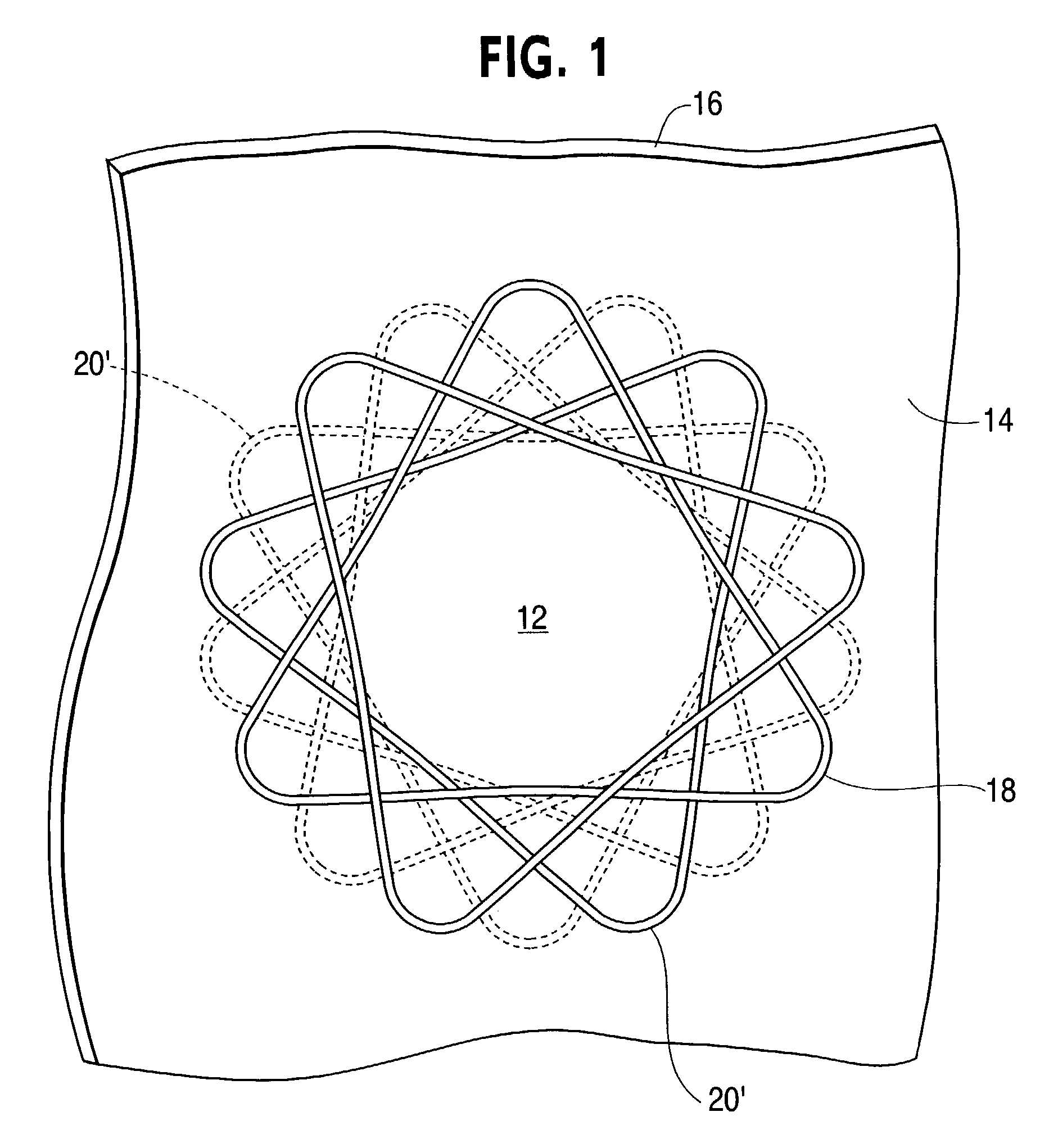 Anastomotic device