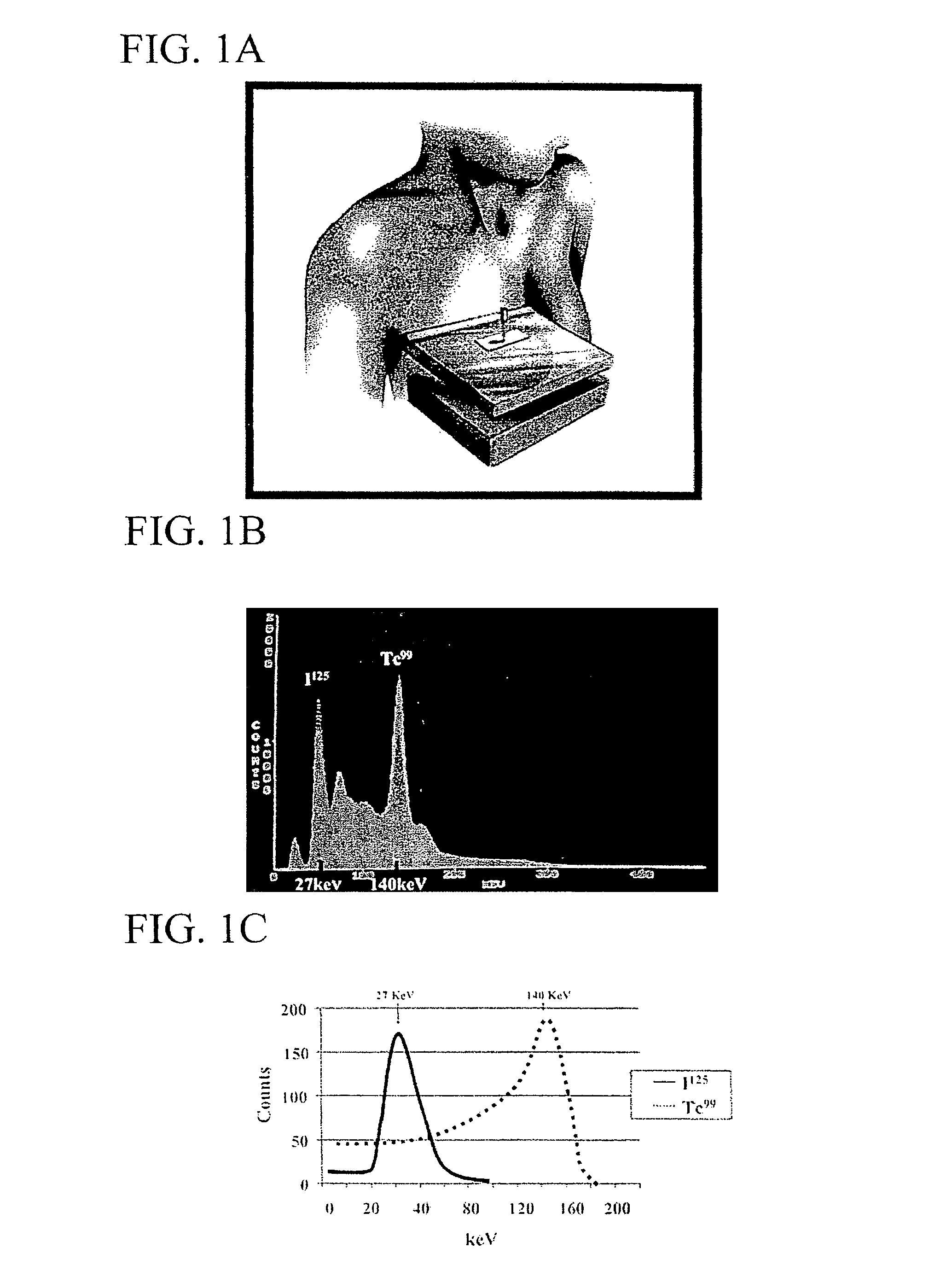 Radio guided seed localization of imaged lesions