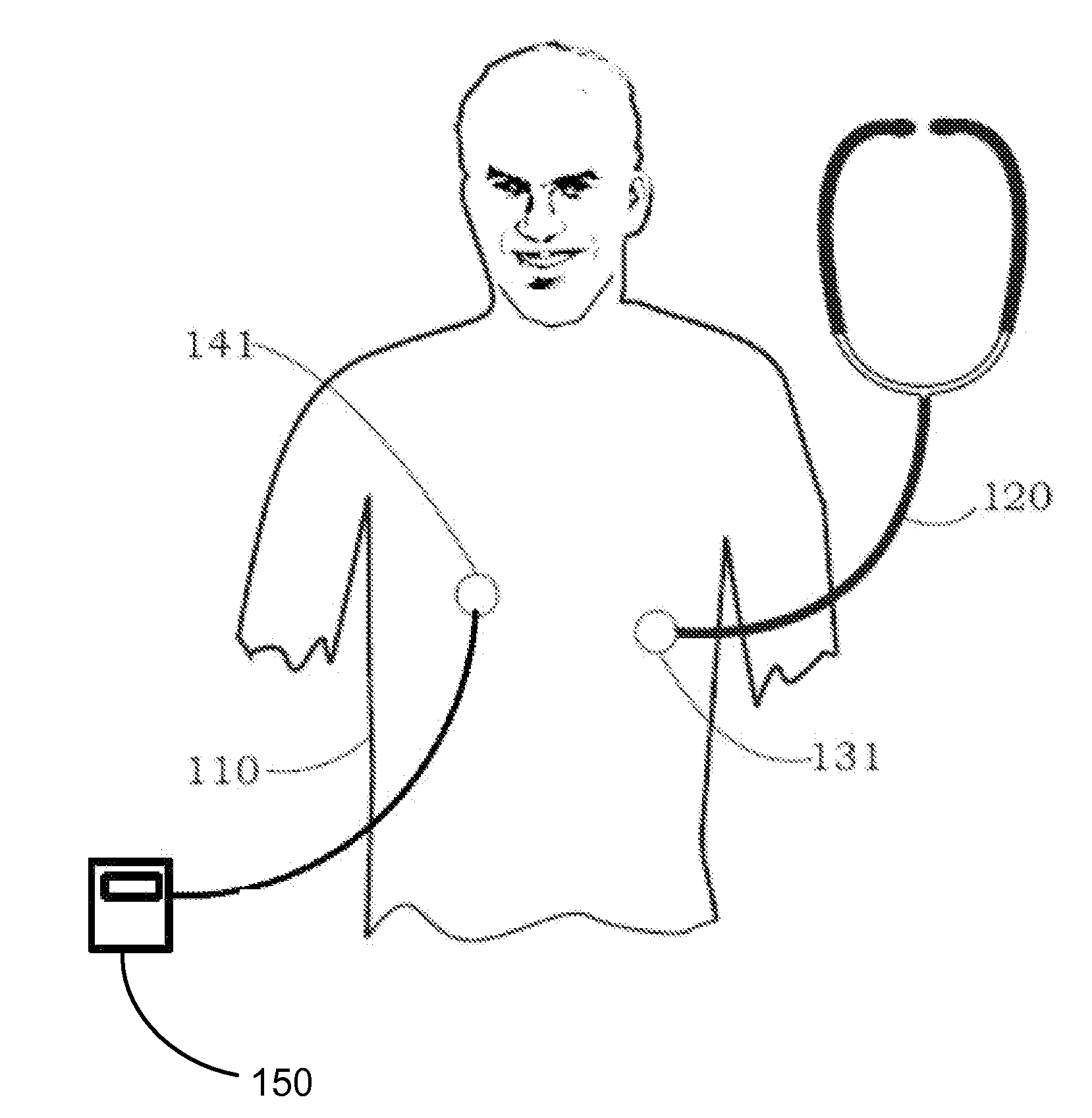 Systems and methods for cardiac contractility analysis