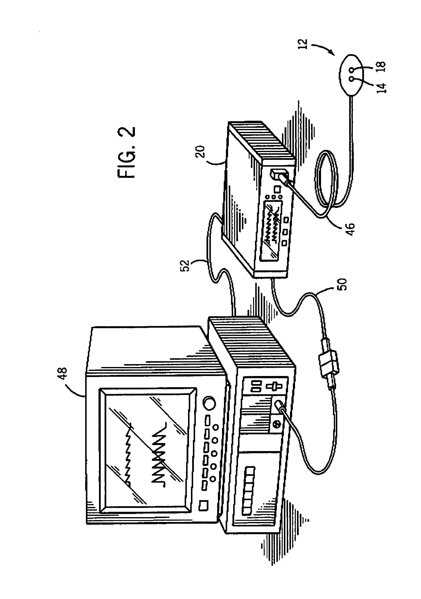 Method for detection of aberrant tissue spectra