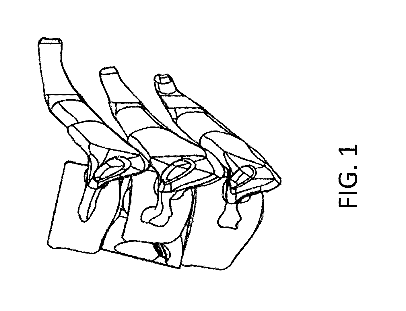 Corpectomy implants with roughened bioactive lateral surfaces