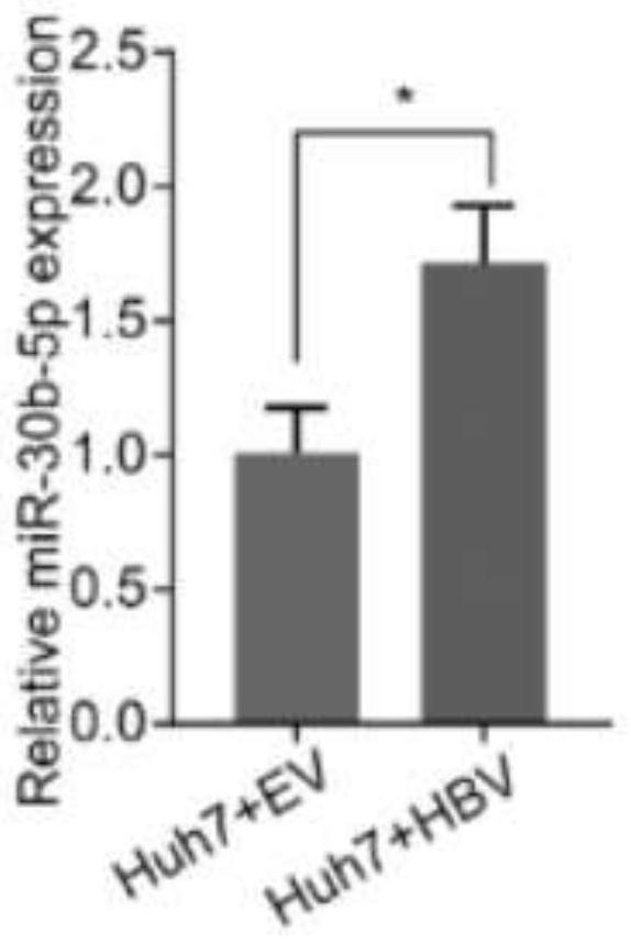 Use of micromolecule RNA-30b-5p as target molecule