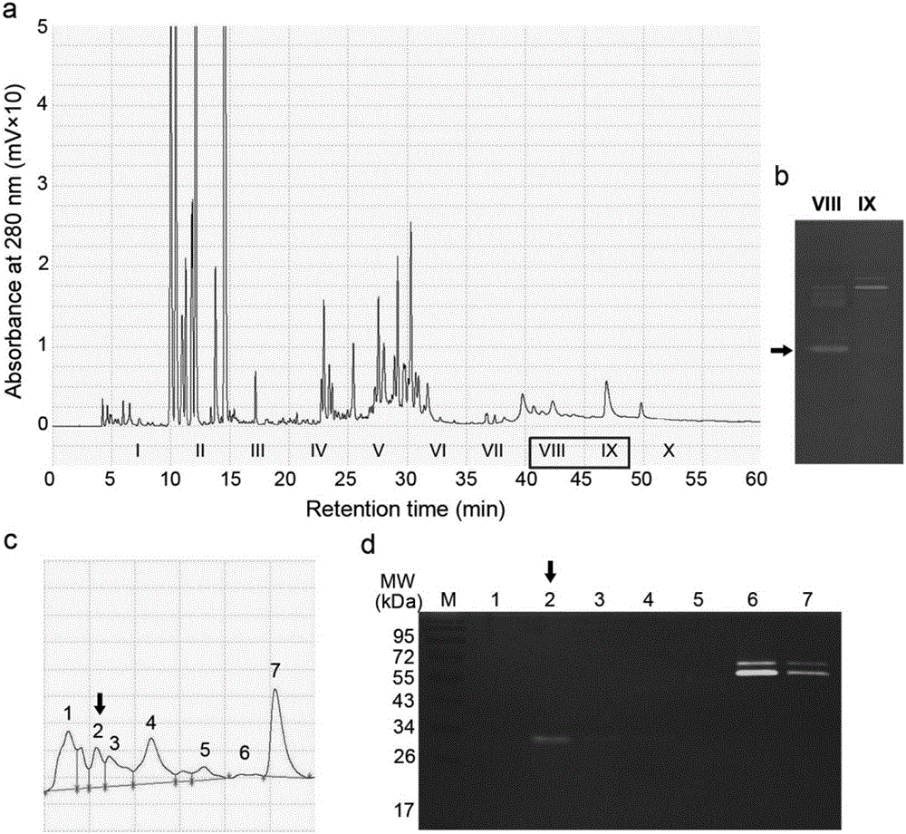 Prostate-specific antigen isomer, coding gene and application thereof