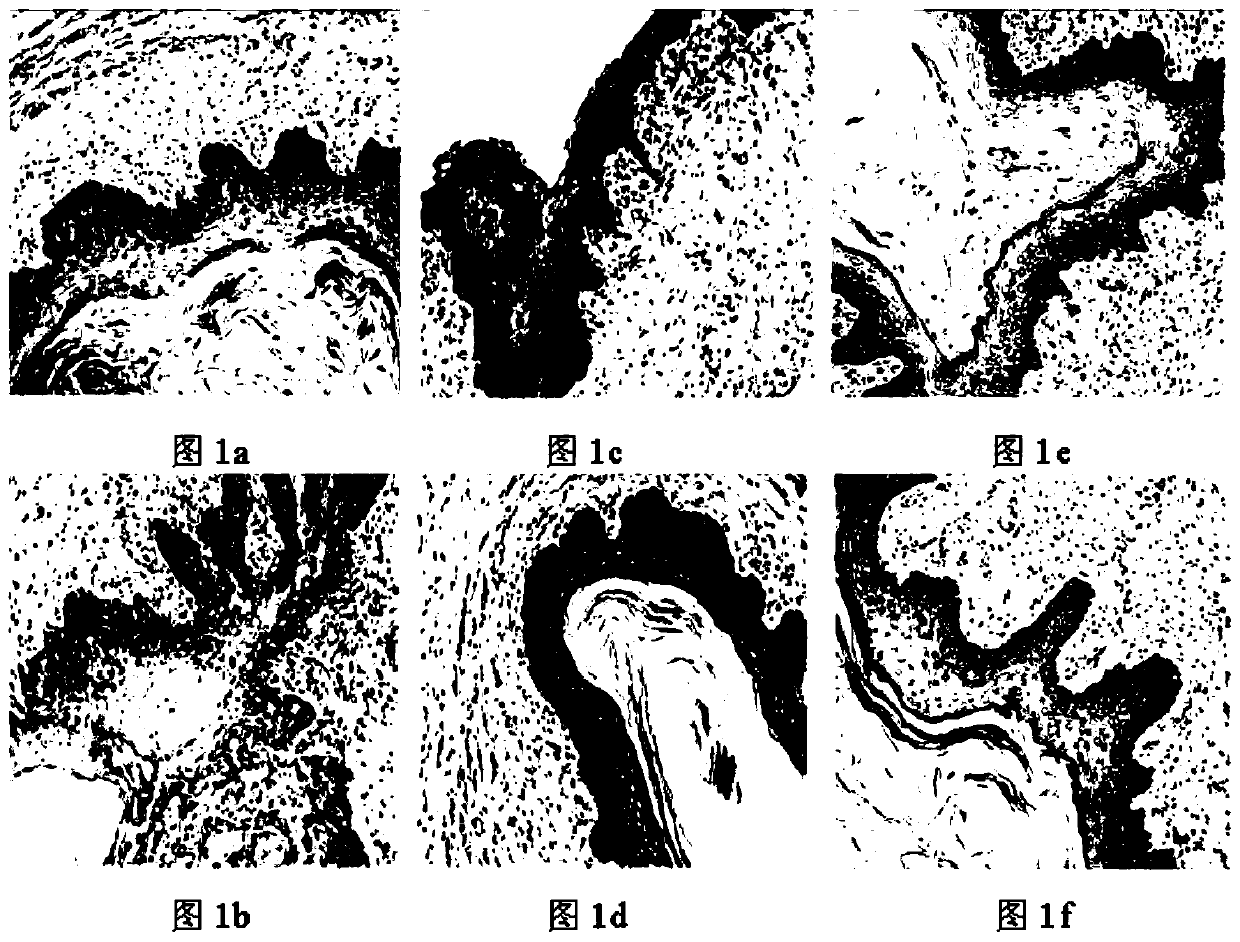 Gynecological antibacterial repair gel and preparation method thereof