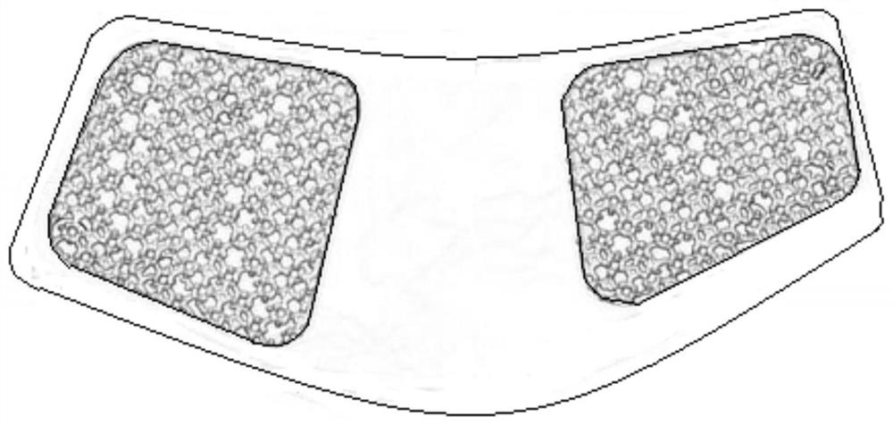 Prosthesis fixing structure for mandible repair and three-dimensional model design method