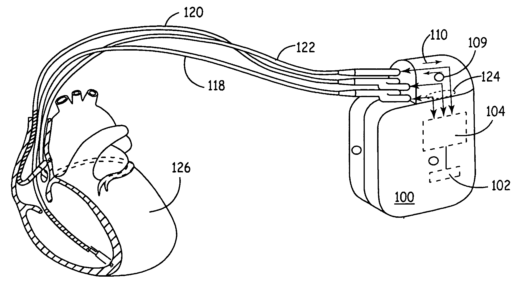 Software configurable medical device platform and associated methods