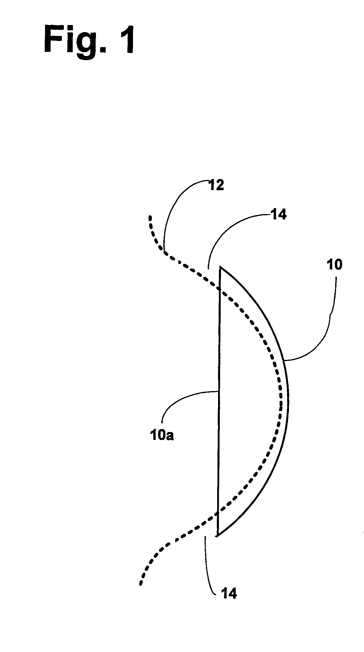 Contact lens with shaped periphery