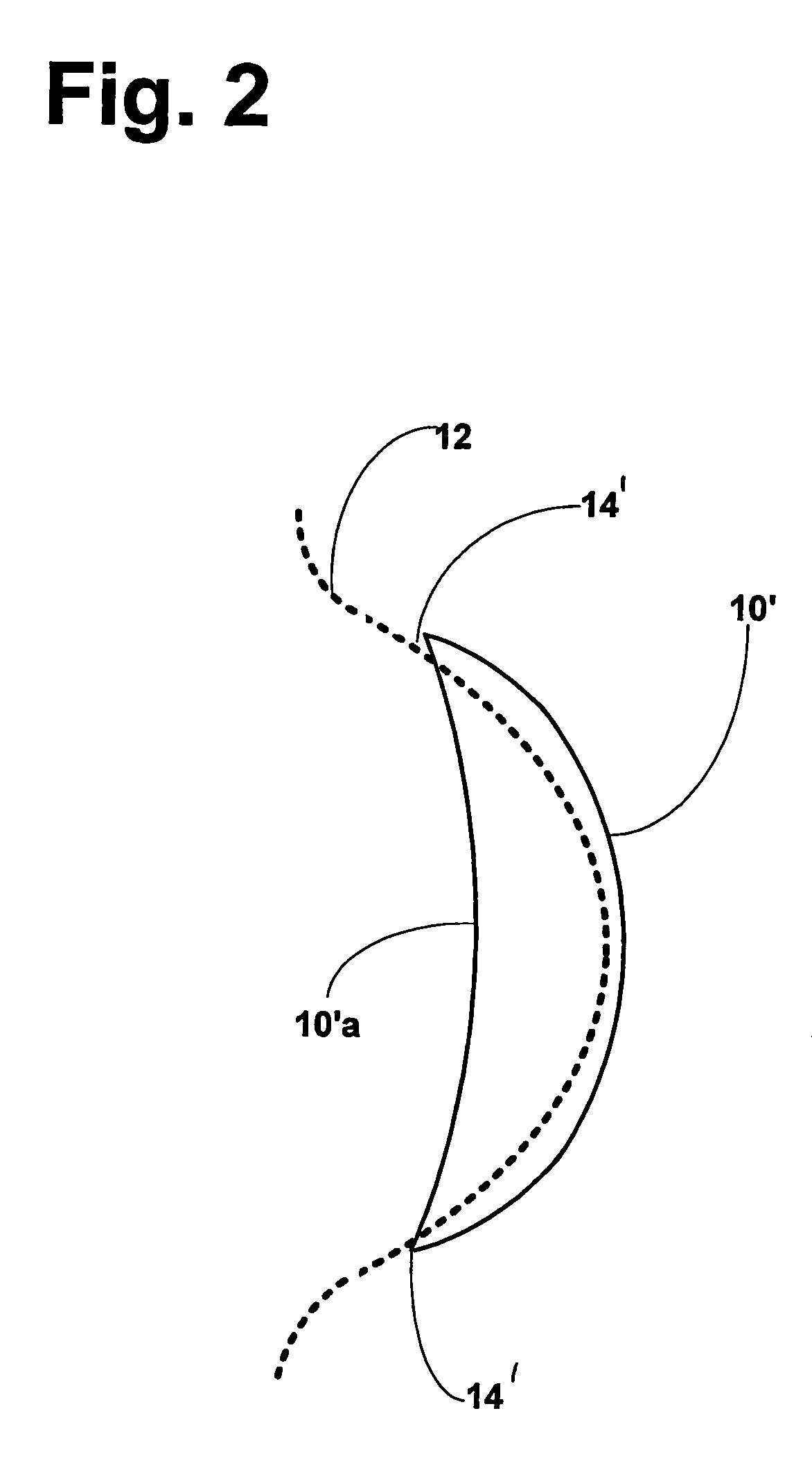 Contact lens with shaped periphery