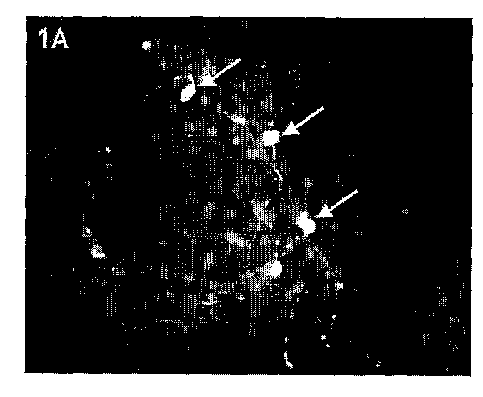 Human immortalised neural precursor cell line