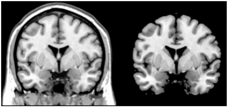 Dynamic brain function connection mode dividing method based on PAC and K-means clustering