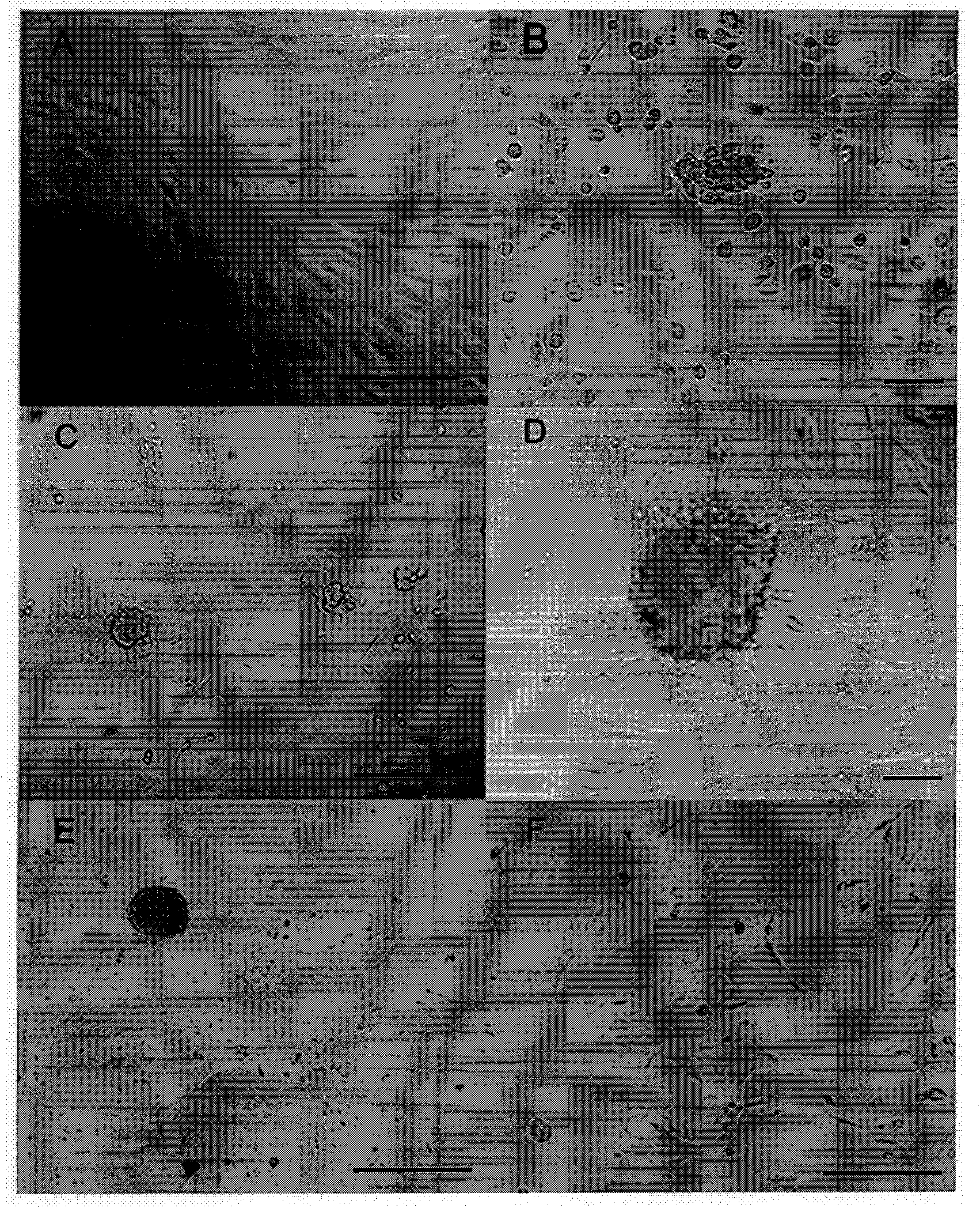 Method and combined medium for preparing insulin-like secreting cells