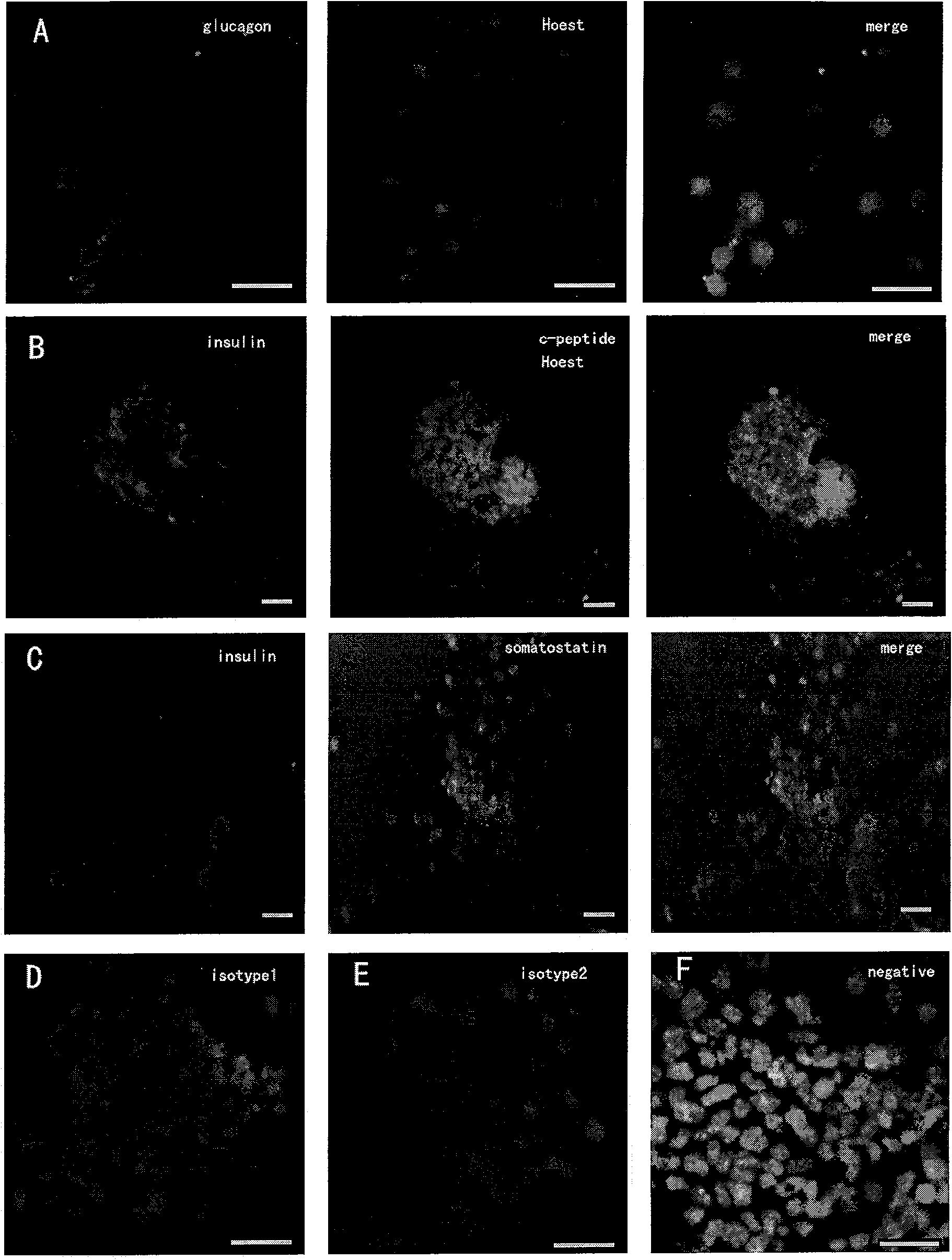 Method and combined medium for preparing insulin-like secreting cells