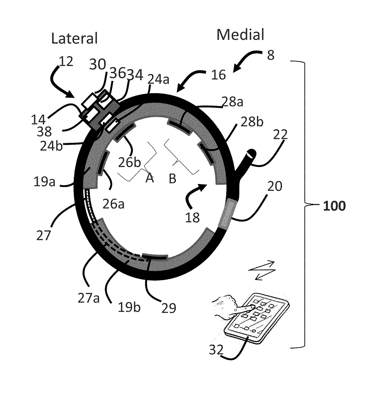 Systems and methods for assessing pelvic floor disorder therapy