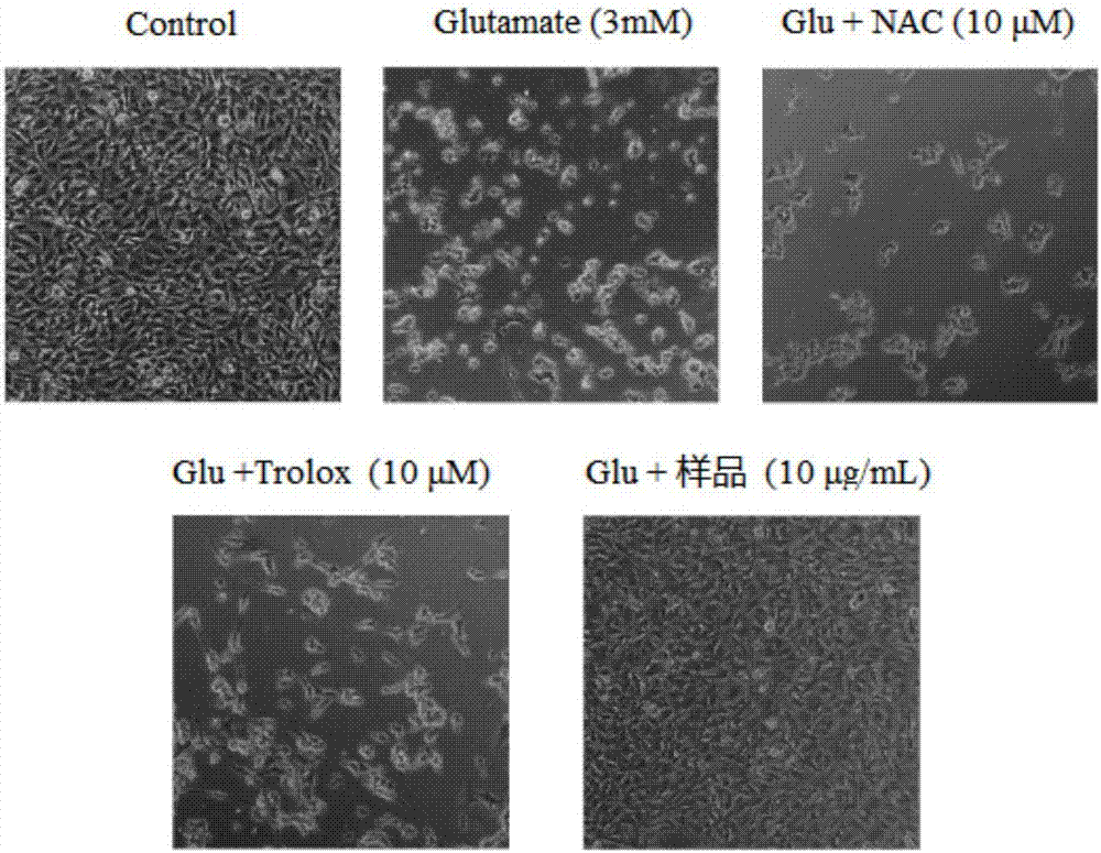 Application of Asystasia gangetica ssp. Micrantha in preparation of drug for preventing and/or treating neurodegenerative disease and drug