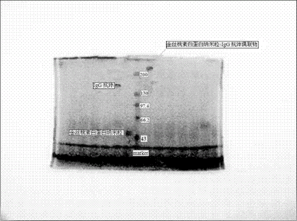 Hypericin albumin nanoparticle-immune globulin G antibody conjugate and preparation method thereof