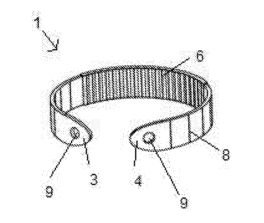 Device for explorable stomach gastric bypass