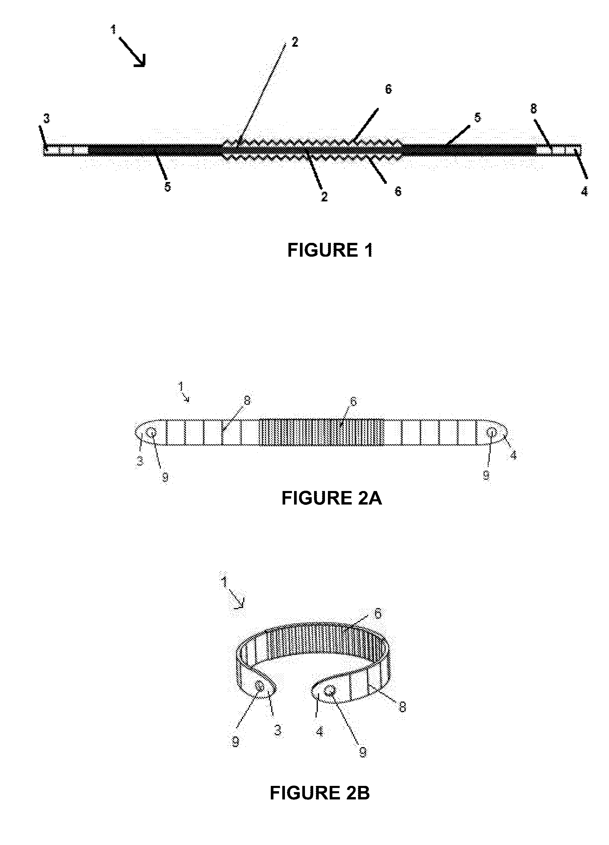 Device for explorable stomach gastric bypass