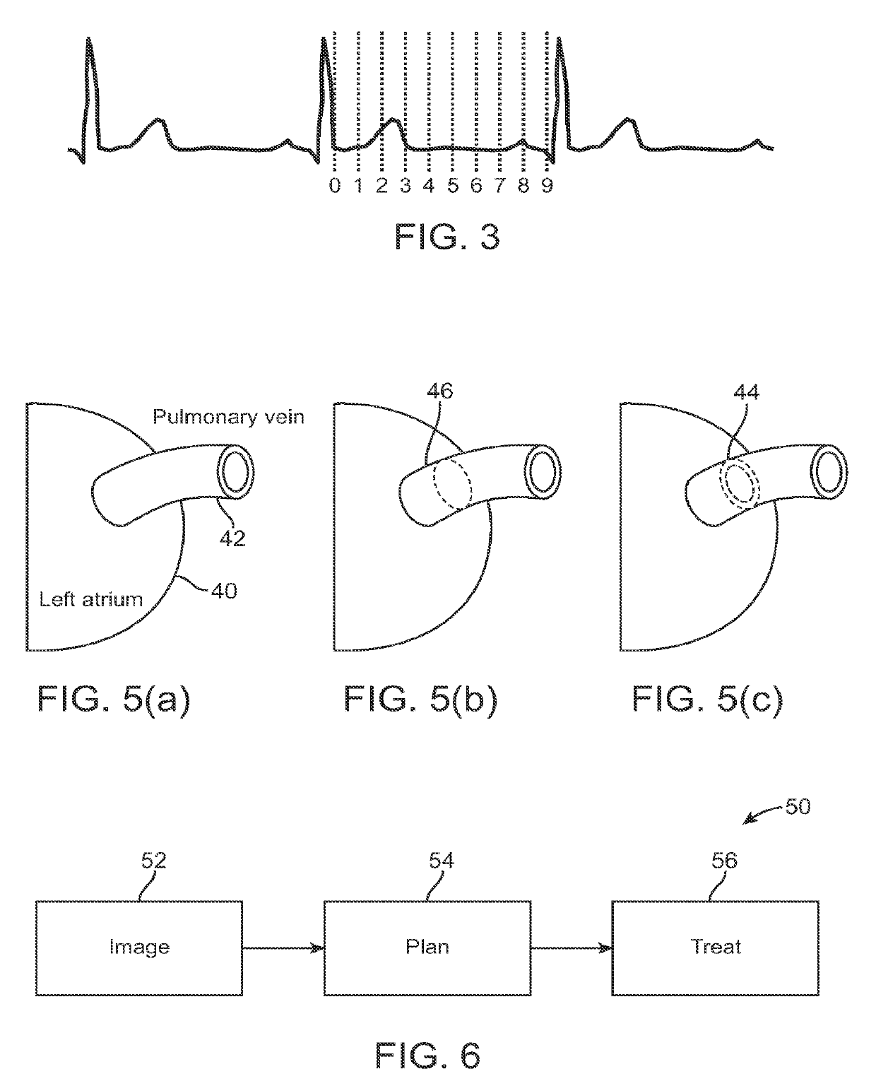 Radiation treatment planning and delivery for moving targets in the heart