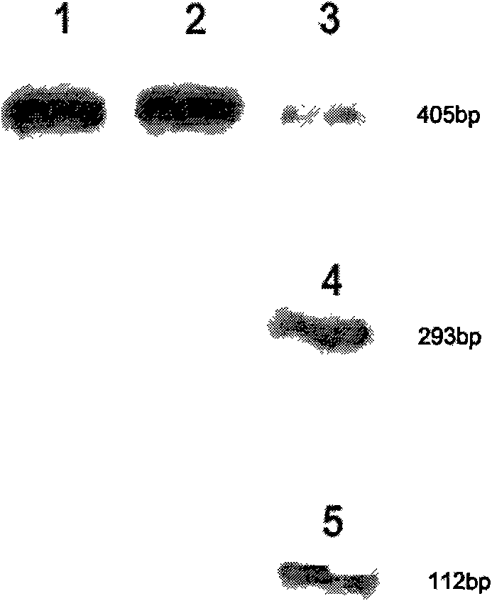 Locked nucleic acid ribozyme of targeted serine-threonine protein kinase aurora kinase A and application thereof