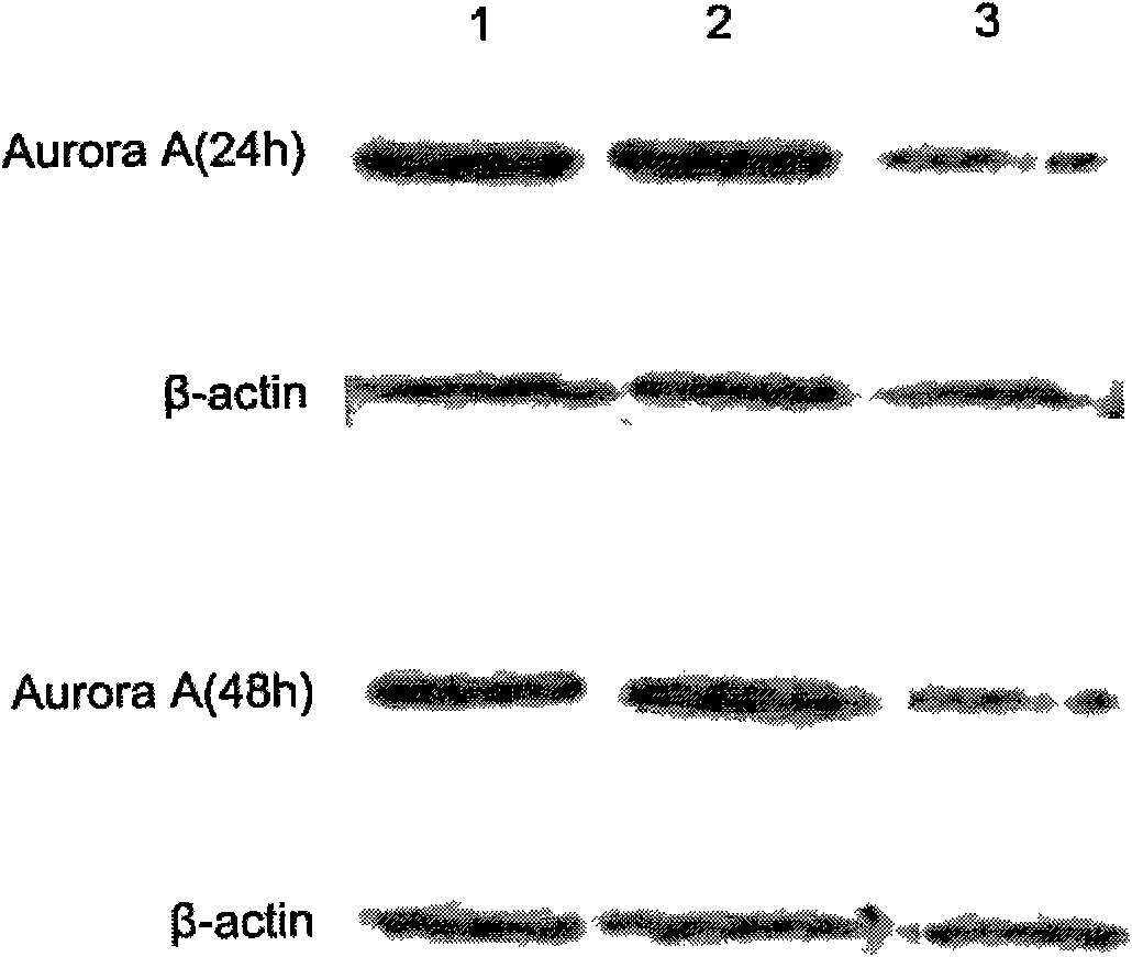 Locked nucleic acid ribozyme of targeted serine-threonine protein kinase aurora kinase A and application thereof