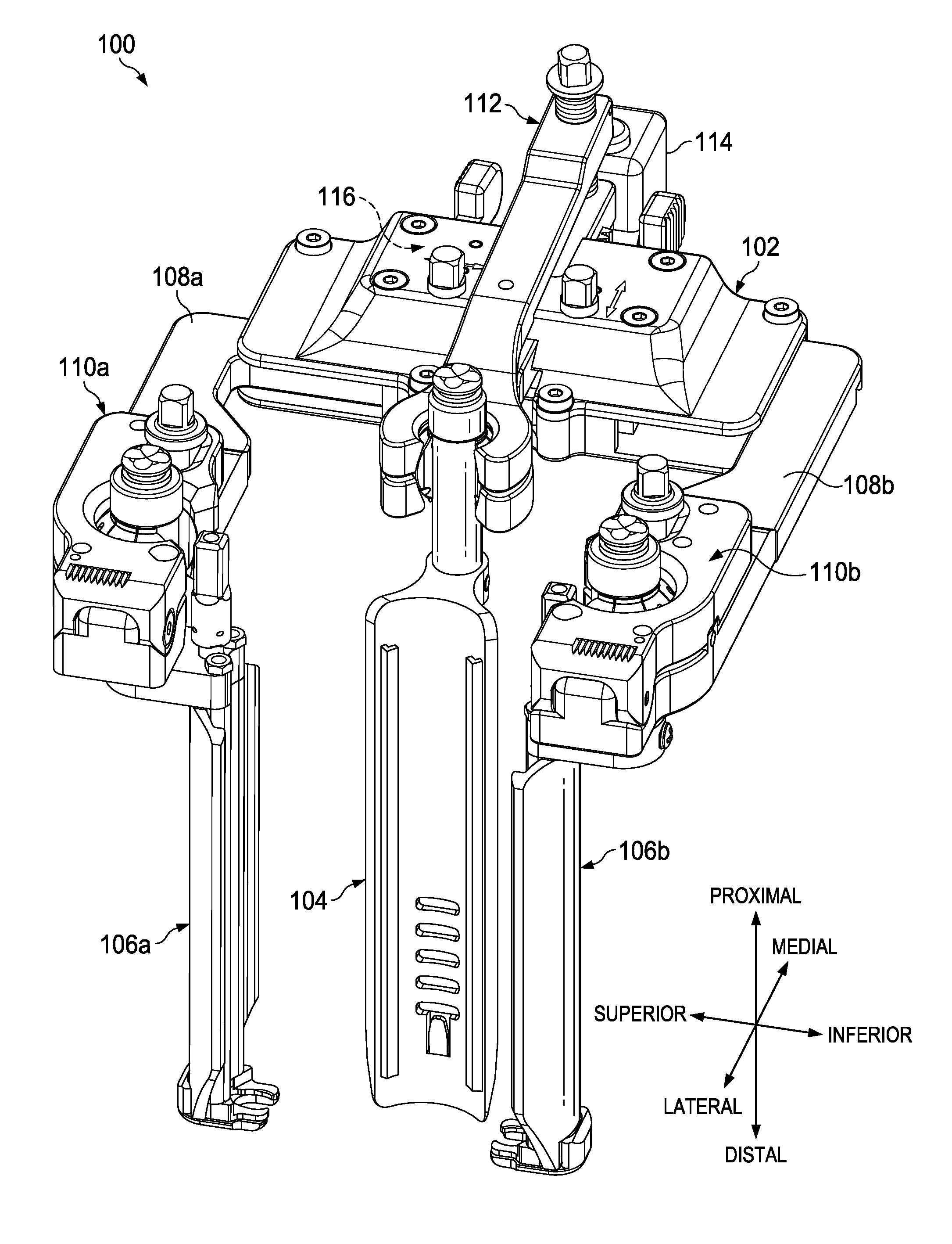 Integrated retractor-distractor system for use with modular bone screws