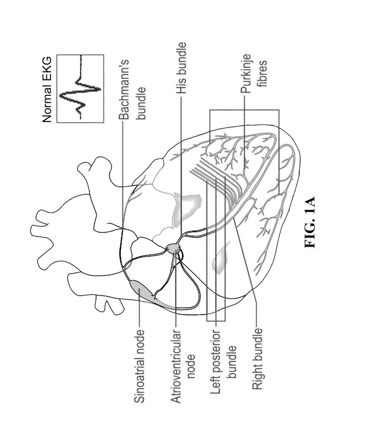 Induced pacemaker and Purkinje cells from adult stem cells