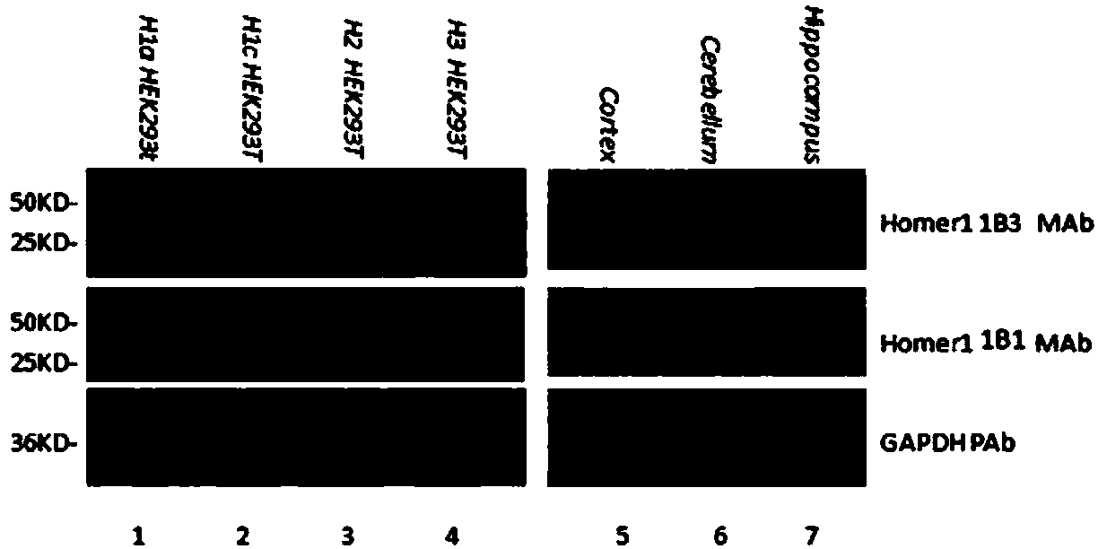 Homer1 Monoclonal antibody and application thereof