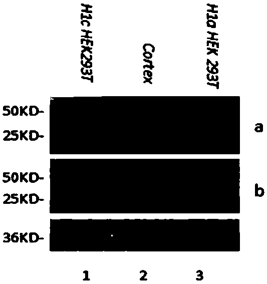 Homer1 Monoclonal antibody and application thereof