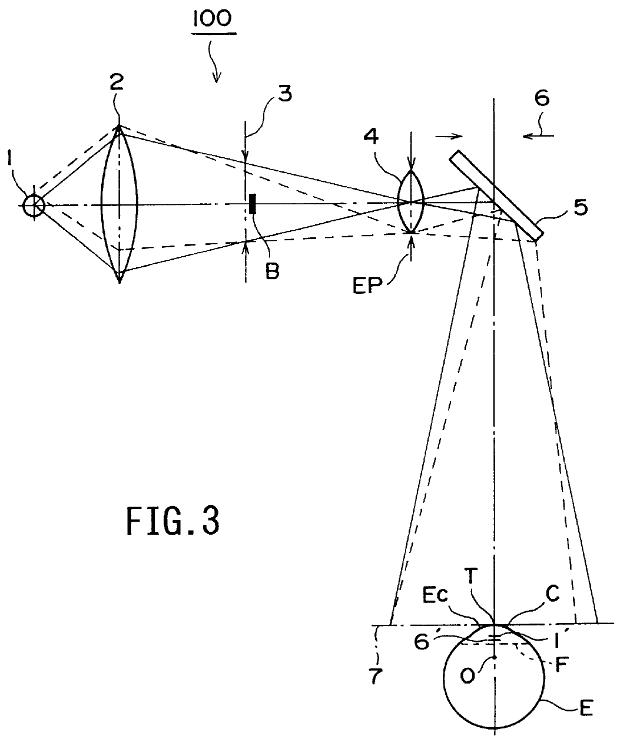 Operation microscope