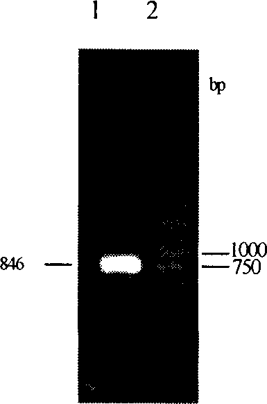 Group-B type-II Coxsackie virus gene vaccine