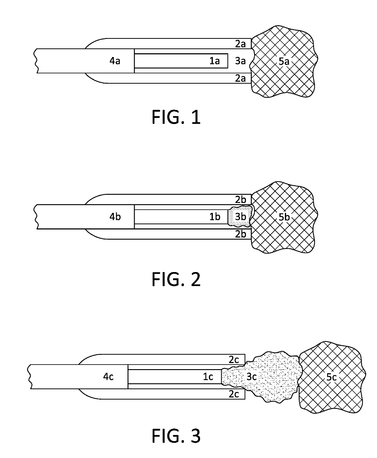 Method of reducing retro-repulsion during laser lithotripsy