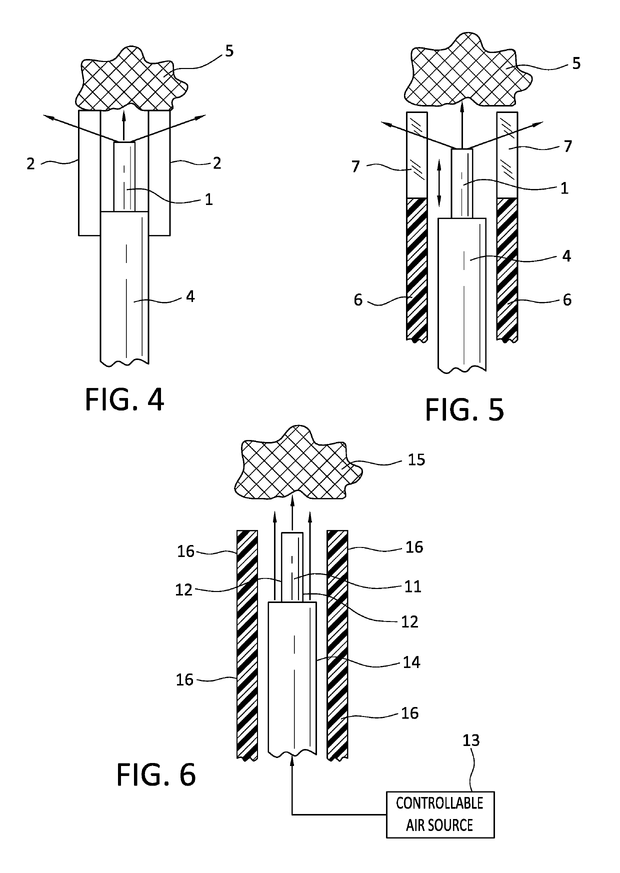 Method of reducing retro-repulsion during laser lithotripsy