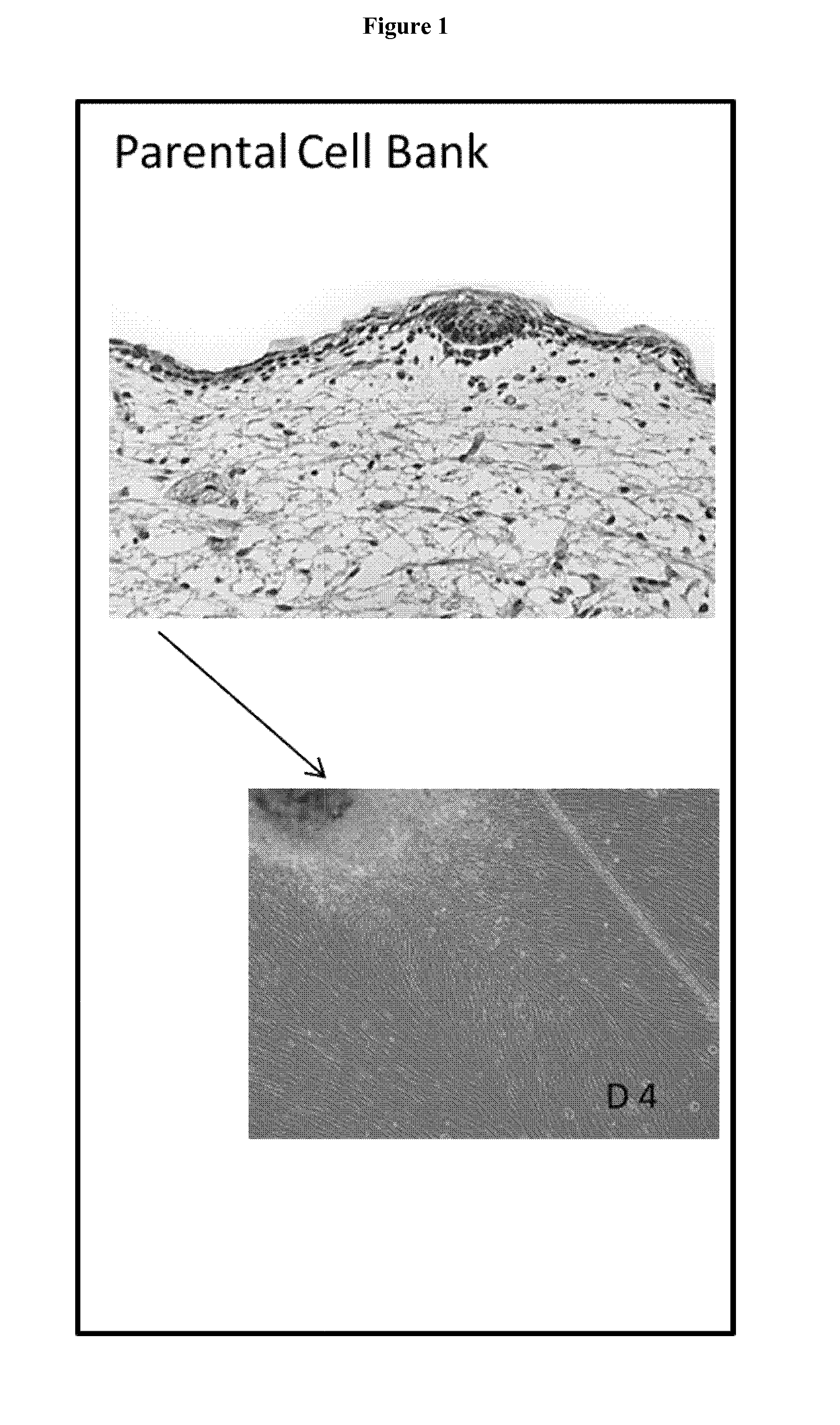 Preparation of parental cell bank from foetal tissue